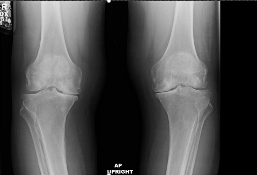 Quiz | Division of Rheumatology | Washington University in St. Louis